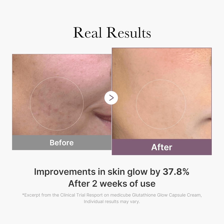 GLUTAYHIONE GLOW CAPSULE CREAM